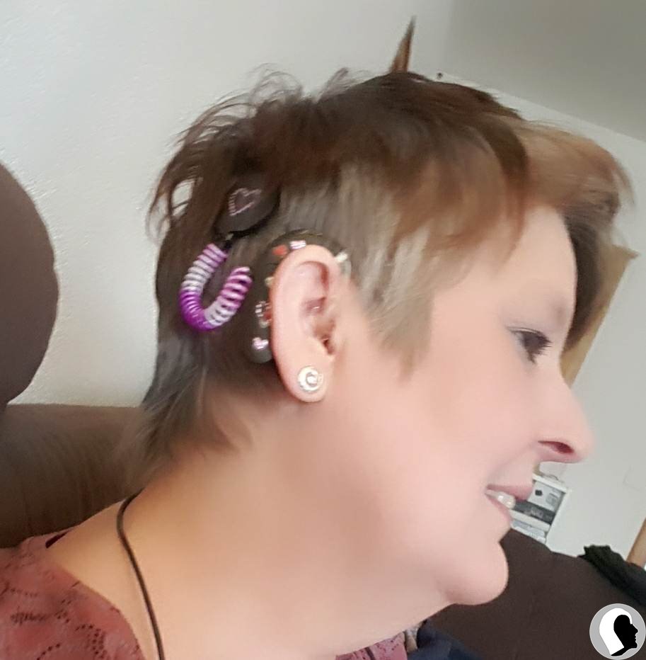 CI Kopf 2018 Erwachsen